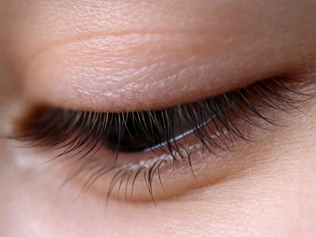 Can Eyelashes Grow Into Your Eye? Causes and What to Do Now
