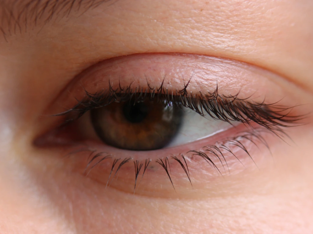 Close-up of an eye lash line showing visibly broken and shorter lashes from irritation and rubbing.